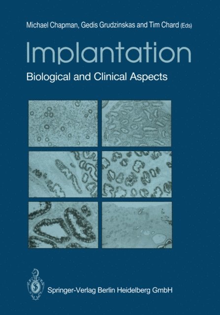 Tim Chard, J.Gedis Grudzinskas, Michael G. Chapman - Implantation, E-bok