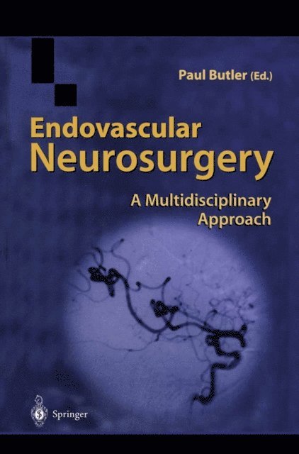 Paul Butler - Endovascular Neurosurgery, E-bok