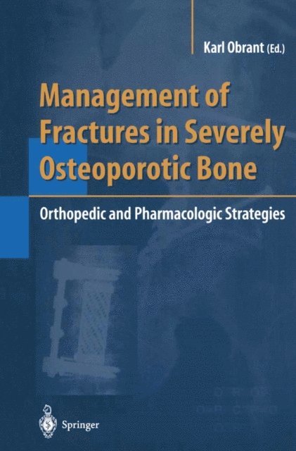 Karl Obrant - Management of Fractures in Severely Osteoporotic Bone, E-bok