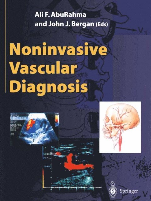 John Bergan, Ali F. AbuRahma - Noninvasive Vascular Diagnosis, E-bok