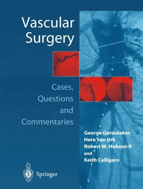 Keith D. Calligaro, Robert W. Hobson II, Hero van Urk, George Geroulakos - Vascular Surgery, E-bok
