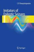 Imitators of epileptic seizures
