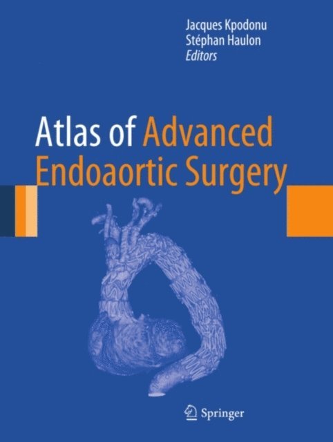 Stephan Haulon, Jacques Kpodonu - Atlas of Advanced Endoaortic Surgery, E-bok