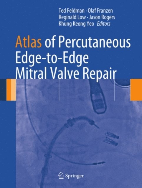 Khung Keong Yeo, Jason Rogers, Reginald Low, Olaf Franzen, Ted Feldman - Atlas of Percutaneous Edge-to-Edge Mitral Valve Repair, E-bok