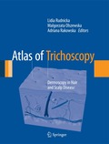 Atlas of Trichoscopy