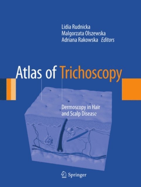 Adriana Rakowska, Malgorzata Olszewska, Lidia Rudnicka - Atlas of Trichoscopy, E-bok