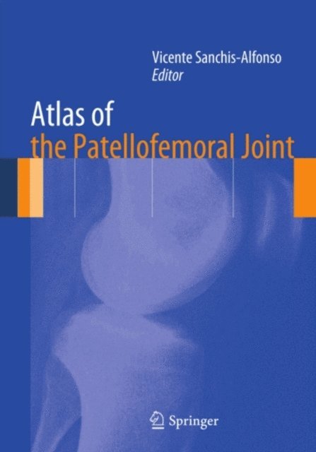Vicente Sanchis-Alfonso - Atlas of the Patellofemoral Joint, E-bok