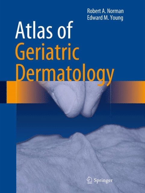 Edward M. Young, Jr, Robert A. Norman - Atlas of Geriatric Dermatology, E-bok