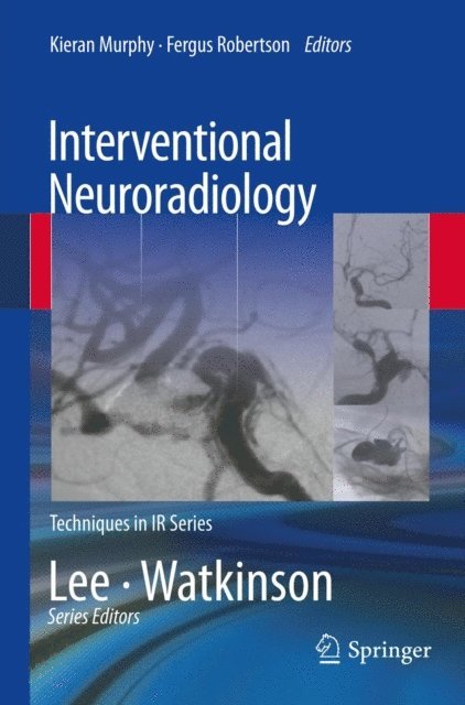 Fergus Robertson, Kieran Murphy - Interventional Neuroradiology, E-bok