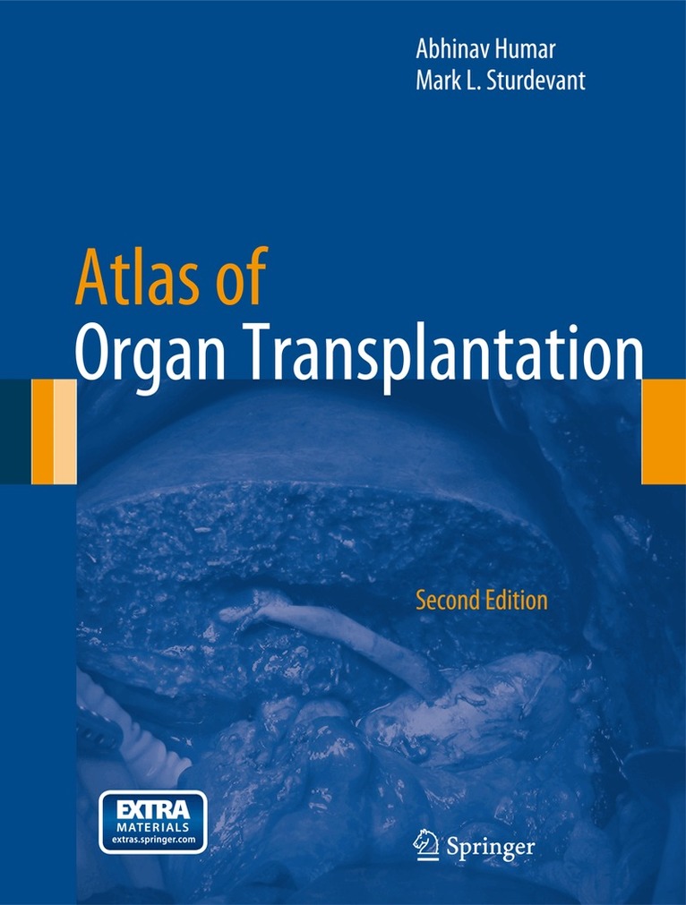 Abhinav Humar, Mark L. Sturdevant - Atlas of Organ Transplantation, Inbunden. Tillgänglighet: Lägg i varukorg