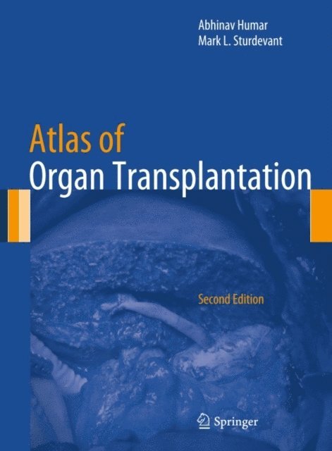 Mark L. Sturdevant, Abhinav Humar - Atlas of Organ Transplantation, E-bok. Tillgänglighet: Lägg i varukorg