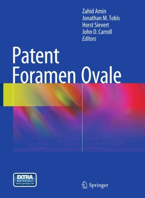John D. Carroll, Horst Sievert, Jonathan M. Tobis, Zahid Amin - Patent Foramen Ovale, E-bok