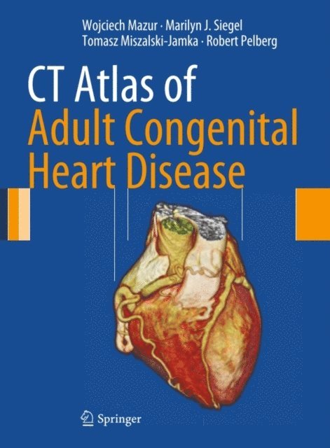 Robert Pelberg, Tomasz Miszalski-Jamka, Marilyn J. Siegel, Wojciech Mazur - CT Atlas of Adult Congenital Heart Disease, E-bok