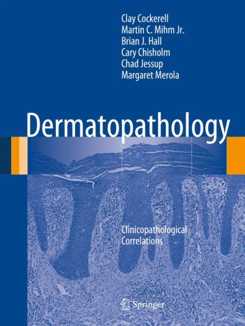 Margaret Merola, Chad Jessup, Cary Chisholm, Brian J. Hall, Martin C. Mihm Jr., Clay Cockerell - Dermatopathology, E-bok