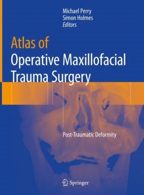 Simon Holmes, Michael Perry - Atlas of Operative Maxillofacial Trauma Surgery, E-bok