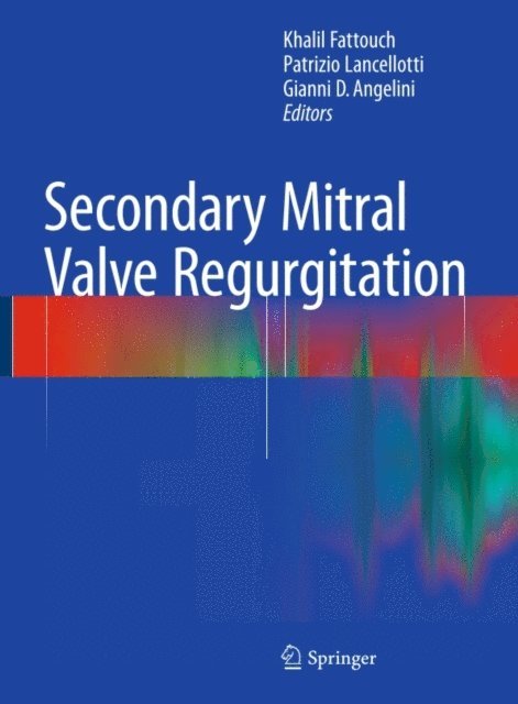 Gianni D. Angelini, Patrizio Lancellotti, Khalil Fattouch - Secondary Mitral Valve Regurgitation, E-bok
