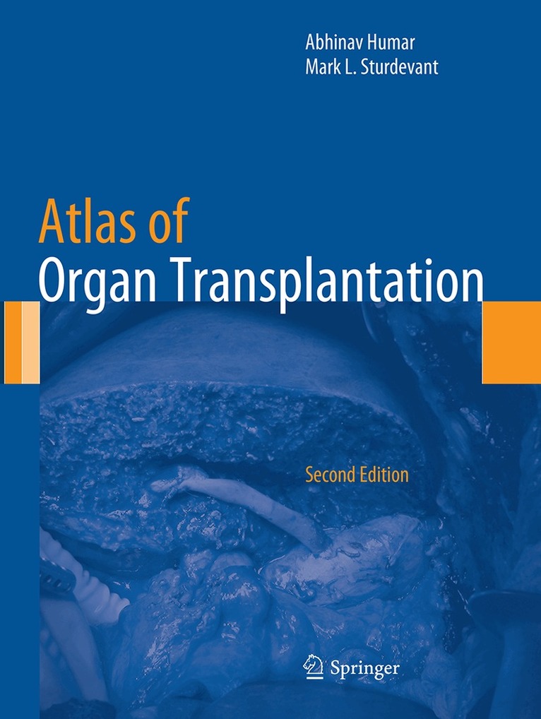 Abhinav Humar, Mark L. Sturdevant - Atlas of Organ Transplantation, Häftad. Tillgänglighet: Lägg i varukorg
