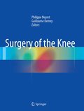 Surgery of the Knee