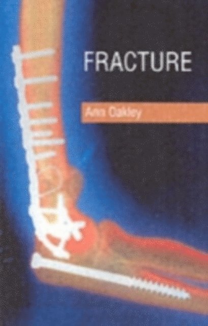 Ann Oakley - Fracture, E-bok