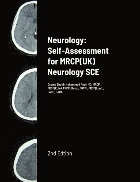 Osama Shukir Muhammed Amin - Neurology: Self-Assessment for MRCP(UK) Neurology SCE, E-bok. Tillgänglighet: Lägg i varukorg