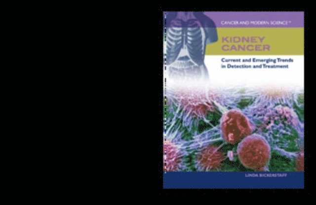 Linda Bickerstaff - Kidney Cancer, E-bok
