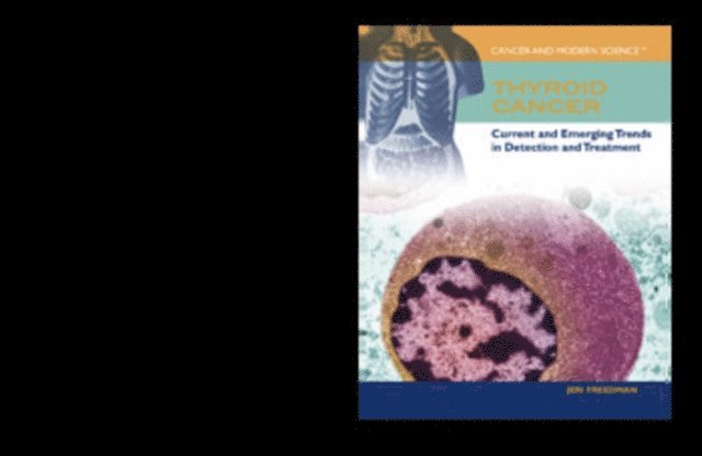 Jeri Freedman - Thyroid Cancer, E-bok