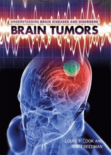 Louis J. Cook, Jeri Freedman - Brain Tumors, E-bok
