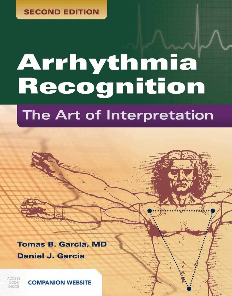Tomas B. Garcia, Daniel J. Garcia - Arrhythmia Recognition: the Art of Interpretation, Häftad