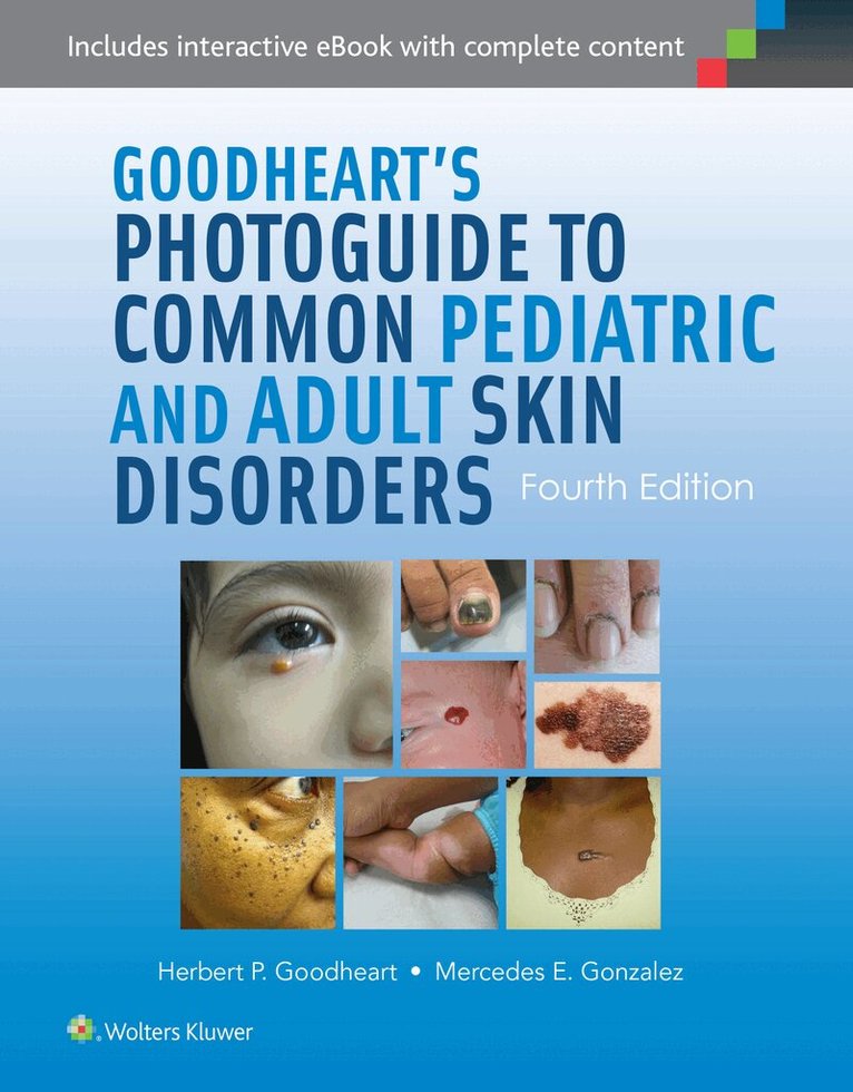 Herbert Goodheart, Mercedes Gonzalez - Goodheart's Photoguide to Common Pediatric and Adult Skin Disorders, Inbunden. Tillgänglighet: Lägg i varukorg