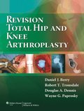 Revision Total Hip and Knee Arthroplasty