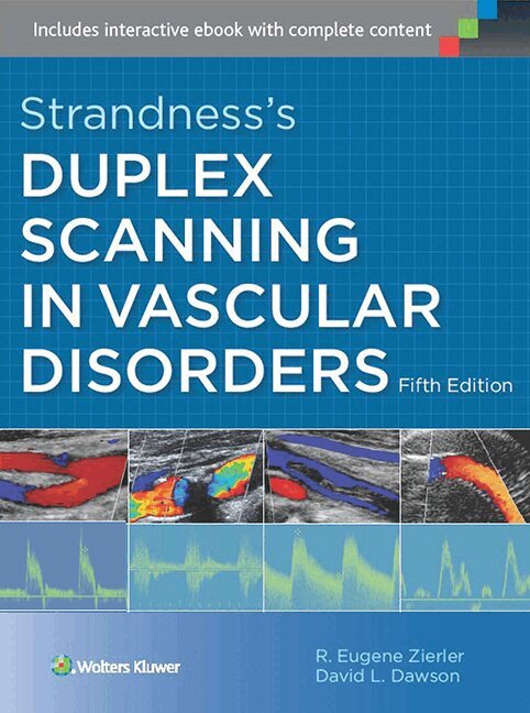 R. Eugene Zierler, David L Dawson - Strandness's Duplex Scanning in Vascular Disorders, Inbunden. Tillgänglighet: Lägg i varukorg