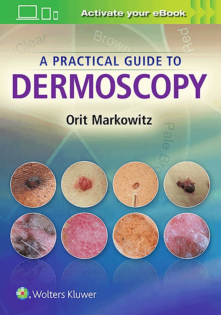 Practical Guide to Dermoscopy