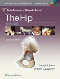 Master Techniques in Orthopaedic Surgery: The Hip