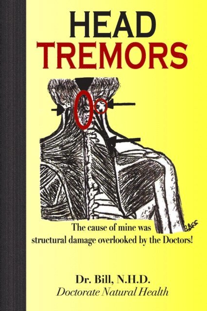 N.H.D. Dr.Bill - HEAD TREMORS, the cause of mine overlooked by Doctors, E-bok. Tillgänglighet: Lägg i varukorg