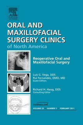 Rui Fernandes, Luis Vega - Reoperative Oral and Maxillofacial Surgery, An Issue of Oral and Maxillofacial Surgery Clinics, Inbunden