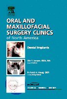 Ole Jensen - Dental Implants, An Issue of Oral and Maxillofacial Surgery Clinics, Inbunden