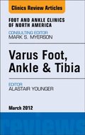 Varus Foot, Ankle, and Tibia,  An Issue of Foot and Ankle Clinics