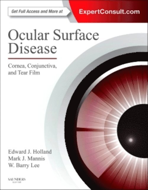 W. Barry Lee, Mark J. Mannis, Edward J. Holland - Ocular Surface Disease: Cornea, Conjunctiva and Tear Film E-Book, E-bok