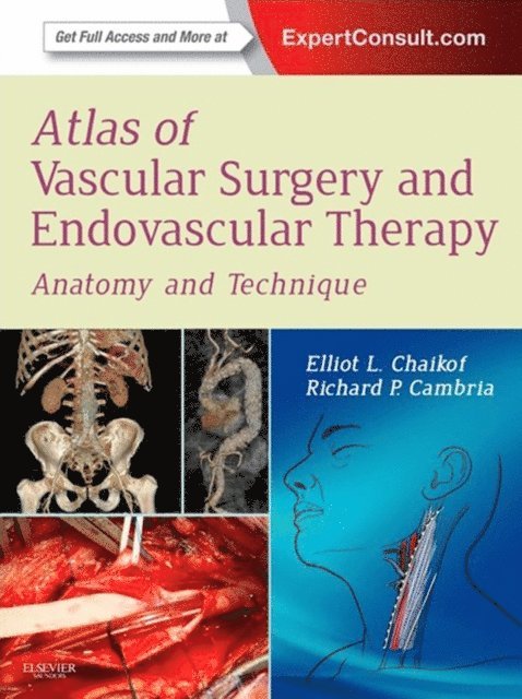 Elliot L. Chaikof - Atlas of Vascular Surgery and Endovascular Therapy E-Book, E-bok. Tillgänglighet: Lägg i varukorg