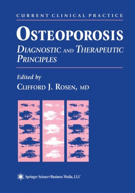 Clifford J. Rosen - Osteoporosis, E-bok