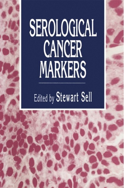 Stewart Sell - Serological Cancer Markers, E-bok