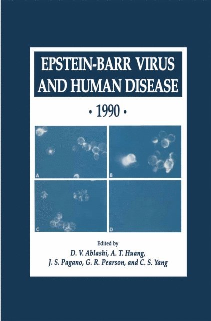 C. S. Yang, G. R. Pearson, J. S. Pagano, A. T. Huang, D. V. Ablashi - Epstein-Barr Virus and Human Disease * 1990, E-bok