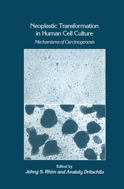 Anatoly Dritschilo, Johng S. Rhim - Neoplastic Transformation in Human Cell Culture, E-bok
