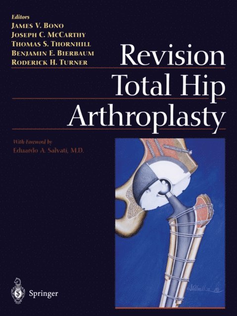 Roderick H. Turner, Benjamin E. Bierbaum, Thomas S. Thornhill, Joseph C. McCarthy, James V. Bono - Revision Total Hip Arthroplasty, E-bok. Tillgänglighet: Lägg i varukorg