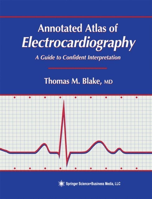 Thomas M. Blake - Annotated Atlas of Electrocardiography, E-bok