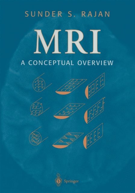 Sunder S. Rajan - MRI, E-bok. Tillgänglighet: Lägg i varukorg