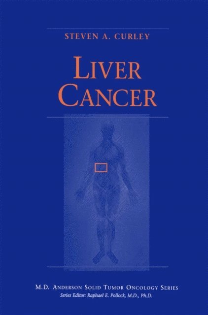 Steven A. Curley - Liver Cancer, E-bok