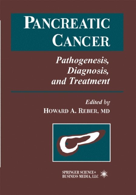 Howard Reber - Pancreatic Cancer, E-bok. Tillgänglighet: Lägg i varukorg