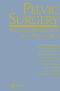 Pelvic Surgery
