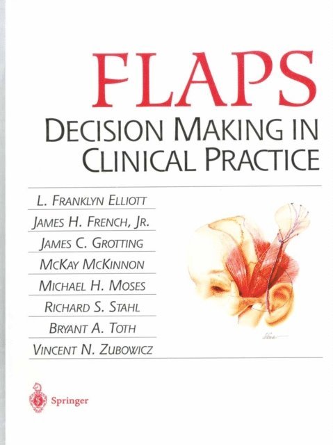 Vincent N. Zubowicz, Bryant A. Toth, Richard S. Stahl, Michael H. Moses, McKay McKinnon, James C. Grotting, James H. Jr. French, L. Franklyn Elliot - FLAPS, E-bok